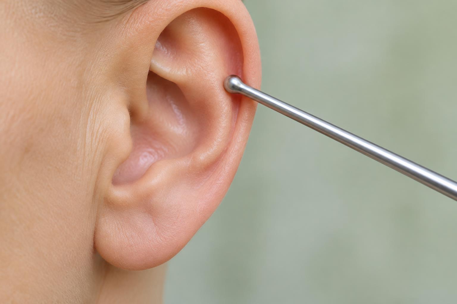 Auricoloterapia
